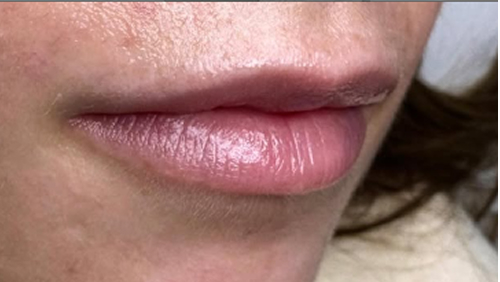 Rectangle 44 (1) Rectangle 44 (1)